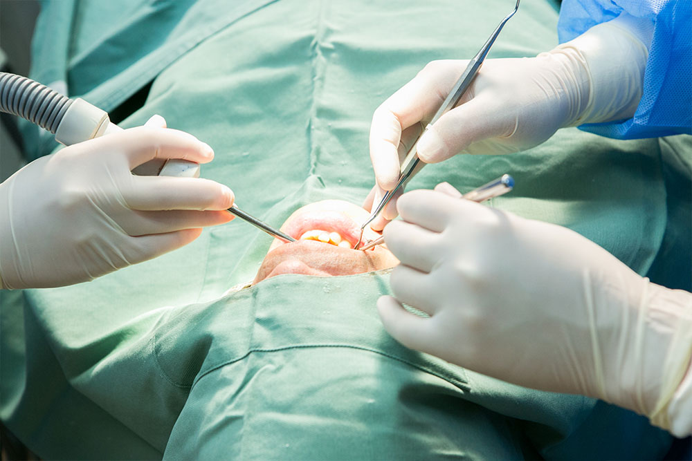 再植術や歯根端切除