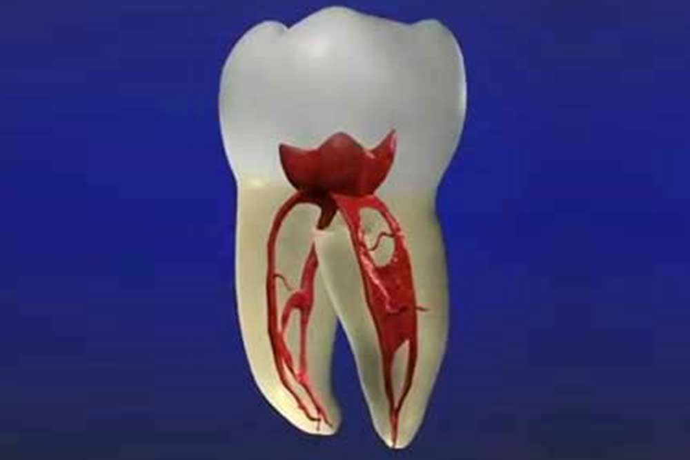 虫歯や歯周病の治療